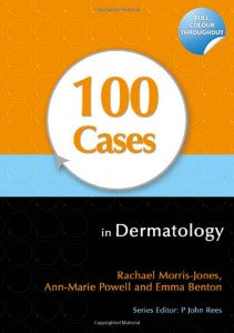 100 Cases in Dermatology
